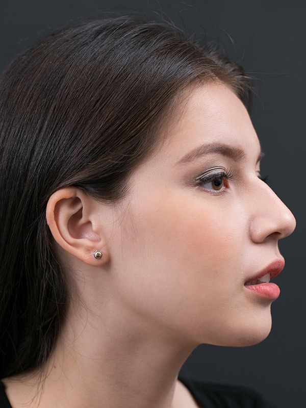 Pinion Studs